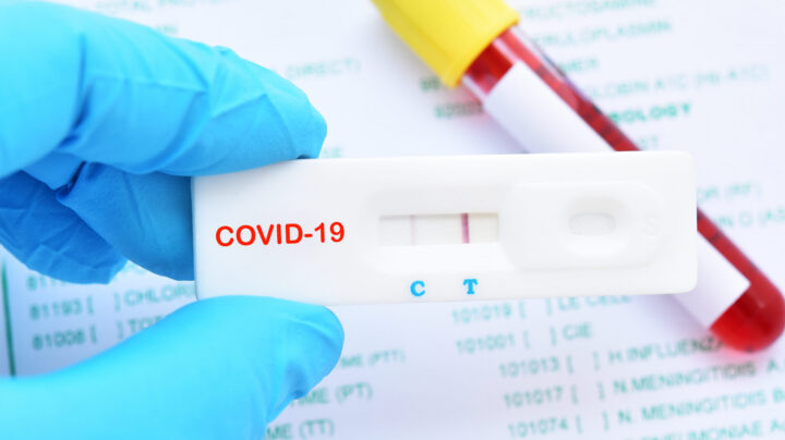 Positive test result by using rapid test device for COVID-19, novel coronavirus 2019 found in Wuhan, China