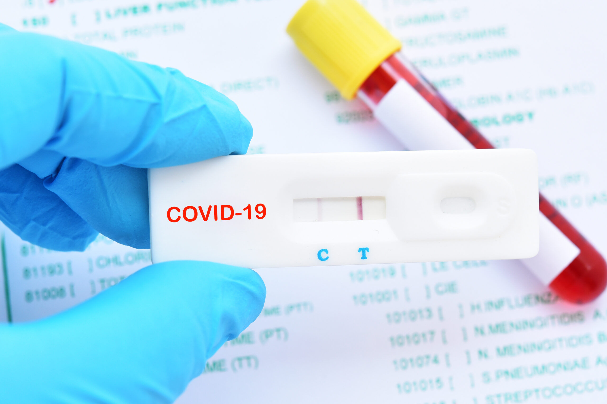 Positive test result by using rapid test device for COVID-19, novel coronavirus 2019 found in Wuhan, China
